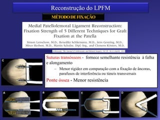 Controle radiográfico - Ponto anatômico
 