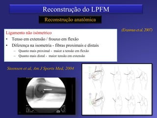Inserção Patelar
Duas bandas
B. Oblíqua Superior – Dinâmico
30 º VMO
B. Transversa Inferior - Estático
Acima de 30º
 