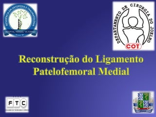 CHEFE DO SERVIÇO HMV
DR. DANIEL ALENCAR
COORDENAÇÃO DA RESIDÊNCIA EM ORTOPEDIA E
TRAUMATOLOGIA
DR. MATEUS AZI
 