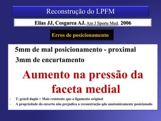 Âncoras Metálicas
X Túneis ósseos
Sem diferença na resistência à tração
Menor chance de fraturas
MÉTODO DE FIXAÇÃO
 