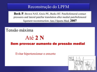Ângulo de fixação do enxerto
Ellera Gomes, Arthroscopy, 1992 90°
Nomura et al, Knee, 2000 60°
Deie et al, JBJS, 2003 30°
Mountney et al, JBJS, 2005 0° - Centralização manual da
patela
Camanho et al, Arthroscopy, 2007 30° a 45°
Cohen et al, Knee Tech, 2010 45° a 60°
 