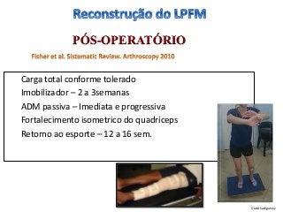 PÓS-OPERATÓRIO
Carga total conforme tolerado
Imobilizador – 2 a 3semanas
ADM passiva – Imediata e progressiva
Fortalecimento isometrico do quadríceps
Retorno ao esporte – 12 a 16 sem.
David Sadigursky
 