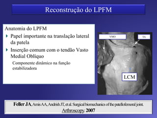 3 camadas
1. Fáscia supericial do sartório
Retináculo medial
Pata de ganso
2. L colateral tibial (Superficial)
LPFM
3. Cápsula articular
L. colateral tibial (Profundo)
L poplíteo oblíquo
Estruturas capsuloligamentares medias
 