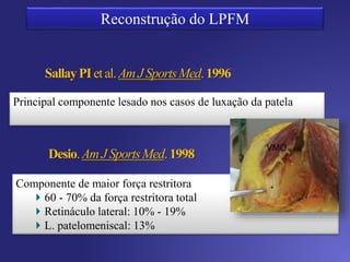 Anatomia do LPFM
Papel importante na translação lateral
da patela
Inserção comum com o tendão Vasto
Medial Oblíquo
Componente dinâmico na função
estabilizadora
VMO TA
LCM
Relação com Vasto Intermédio
Inserção patelar ???
 