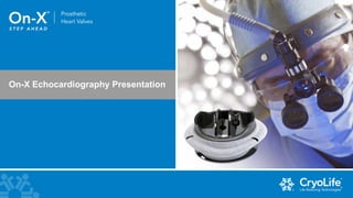 On-X Echocardiography Presentation
 