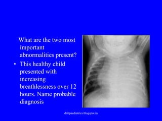 What are the two most
important
abnormalities present?
• This healthy child
presented with
increasing
breathlessness over 12
hours. Name probable
diagnosis
dnbpaediatrics.blogspot.in
 