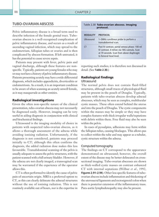 Chapter 288
reporting such studies; it is therefore not discussed in
detail. (See Table 2.30.)
Radiological findings
Ultrasound
The normal pelvis does not contain fluid-filled
structures, although small traces of physiological fluid
may be present in the pouch of Douglas. Typically,
patients with tubo-ovarian abscess develop adnexal
abscesses, which may be seen as complex, multilocular
cystic masses. These often extend behind the uterus
and into the pouch of Douglas. The cystic components
within the masses may be simple or they may have
complex features with thick irregular walls/septations
with debris within them. Free fluid may also be seen
within the pelvis.
In cases of pyosalpinx, adhesions may form within
the fallopian tubes, causing blockages. This allows pus
to collect within the tube and may appear as a tubular,
cystic structure within the adnexa.
Computed tomography
The findings on CT correspond to the appearance
demonstrated on ultrasound; however, the overall
extent of the disease may be better delineated on cross-
sectional imaging. Tubo-ovarian abscesses are shown
as thick-walled cystic masses on contrast enhanced
CT with internal septations (Wilbur et al., 1992,
Figures 2.91–2.94). Other less specific features of tubo-
ovarianabscess includeinflammationandthickeningof
the uterosacral ligaments and rectosigmoid colon when
there is posterior extension of the inflammatory mass.
Para-aortic lymphadenopathy may also be present.
TUBO-OVARIAN ABSCESS
Pelvic inflammatory disease is a broad term used to
describe infection of the female genital tract. Tubo-
ovarian abscess is a well-recognised complication of
pelvic inflammatory disease, and occurs as a result of
ascending vaginal infection, which may spread to the
endometrium, fallopian tubes or ovaries and is then
complicated by abscess formation. If left untreated, it
has the potential to cause severe sepsis.
Patients may present with fever, pelvic pain and
vaginal discharge, although these features are non-
specific.Typically,patientsareyoungfemaleswhomay
ormaynothaveahistoryofpelvicinflammatorydisease.
Patientspresentingacutelymayhaveawidedifferential
diagnosis, which includes appendicitis, diverticulitis or
endometriosis. As a result, it is an important condition
to be aware of when scanning an acutely unwell female,
as it may masquerade as other entities.
Radiological investigations
Given the often non-specific nature of the clinical
presentation, tubo-ovarian abscess may not necessarily
be diagnosed easily. However, imaging can be very
useful in aiding diagnosis in conjunction with clinical
and biochemical findings.
Ultrasound is the imaging modality of choice in
patients with suspected tubo-ovarian abscess, as it
allows a thorough assessment of the adnexa while
avoiding ionising radiation. Unfortunately, if the
diagnosis is not considered, patients may proceed
initially to CT; although this often confirms the
diagnosis, the added radiation dose makes this less
favourable. Transabdominal scanning of the pelvis is
usually adequate to assess the pelvic structures, with the
patient scanned with a full urinary bladder. However, if
the adnexa are not clearly imaged, a transvaginal scan
may be warranted if the experience of the operator
allows this.
CT is often performed to identify the cause of pelvic
pain of uncertain origin. MRI is a preferred option to
CT, as this can clearly delineate the adnexal structures
without the use of ionising radiation. This is not
routinely available out of hours, nor is the expertise in
MODALITY PROTOCOL
Ultrasound 1–5MHz curvilinear probe to perform a
transabdominal scan.
CT Post IV contrast, portal venous phase: 100 ml
IV contrast, 4 ml/sec via 18G cannula. Scan
at 70 seconds. Scan from above diaphragm
to femoral head level.
Table 2.30 Tubo-ovarian abscess. Imaging
protocol.
K22247_C002.indd 88 16/05/15 3:07 AM
 
