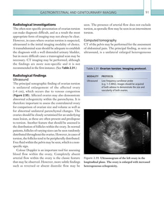 Gastrointestinal and genitourinary imaging 91
Radiological investigations
The often non-specific presentation of ovarian torsion
can make diagnosis difficult, and as a result the most
appropriate form of imaging may not always be clear.
However, in cases where ovarian torsion is suspected,
ultrasound is the initial imaging modality of choice.
A transabdominal scan should be adequate to establish
the diagnosis with a well distended urinary bladder,
but in more difficult cases a transvaginal scan may be
necessary. CT imaging may be performed, although
the findings are more non-specific and it is not
recommended in the first instance. (See Table 2.31.)
Radiological findings
Ultrasound
The principal sonographic finding of ovarian torsion
is unilateral enlargement of the affected ovary
(4 cm), which occurs due to venous congestion
(Figure 2.95). Affected ovaries may also demonstrate
abnormal echogenicity within the parenchyma. It is
therefore important to assess the contralateral ovary
for comparison of ovarian size and volume as well as
for abnormal unilateral parenchymal changes. The
ovaries should be closely scrutinised for an underlying
mass lesion, as these are often present and predispose
to torsion. Another feature that should be assessed is
the distribution of follicles within the ovary. In normal
patients, follicles of varying sizes can be seen randomly
distributedthroughouttheovaries.However,incasesof
torsion, the follicles tend to be peripherally distributed.
Free fluid within the pelvis may be seen, which is a non-
specific sign.
Colour Doppler is an important tool for assessing
blood flow within the ovary. Completely absent
arterial flow within the ovary is the classic feature
that may be observed. However, more subtle findings
such as reversed or absent diastolic flow may be
MODALITY PROTOCOL
Ultrasound Low frequency curvilinear probe
(e.g. 1–5 MHz). Images should be acquired
of both adnexa to demonstrate the size and
vascularity of both ovaries.
Table 2.31  Ovarian torsion. Imaging protocol.
Figure 2.95  Ultrasonogram of the left ovary in the
longitudinal plane. The ovary is enlarged with increased
heterogeneous echogenicity.
seen. The presence of arterial flow does not exclude
torsion, as sporadic flow may be seen in an intermittent
torsion.
Computed tomography
CT of the pelvis may be performed for the assessment
of abdominal pain. The principal finding, as seen on
ultrasound, is a unilateral enlarged heterogeneous
K22247_C002.indd 91 16/05/15 3:07 AM
 
