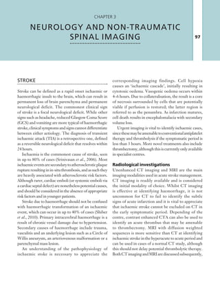 97
Chapter 3
NEUROLOGY AND NON-TRAUMATIC
SPINAL IMAGING
STROKE
Stroke can be defined as a rapid onset ischaemic or
haemorrhagic insult to the brain, which can result in
permanent loss of brain parenchyma and permanent
neurological deficit. The commonest clinical sign
of stroke is a focal neurological deficit. While other
signs such as headache, reduced Glasgow Coma Score
(GCS) and vomiting are more typical of haemorrhagic
stroke,clinicalsymptomsandsignscannotdifferentiate
between either aetiology. The diagnosis of transient
ischaemic attack (TIA) is a retrospective one, defined
as a reversible neurological deficit that resolves within
24 hours.
Ischaemia is the commonest cause of stroke, seen
in up to 80% of cases (Srinivasan et al., 2006). Most
ischaemiceventsaresecondarytoatheroscleroticplaque
ruptureresultinginin-situthrombosis,andassuchthey
are heavily associated with atherosclerotic risk factors.
Although rarer, cardiac emboli (or systemic emboli via
a cardiac septal defect) are nonetheless potential causes,
and should be considered in the absence of appropriate
risk factors and in younger patients.
Stroke due to haemorrhage should not be confused
with haemorrhagic transformation of an ischaemic
event, which can occur in up to 40% of cases (Shiber
et al., 2010). Primary intracerebral haemorrhage is a
result of chronic vessel damage due to hypertension.
Secondary causes of haemorrhage include trauma,
vasculitis and an underlying lesion such as a Circle of
Willis aneurysm, an arteriovenous malformation or a
parenchymal mass lesion.
An understanding of the pathophysiology of
ischaemic stoke is necessary to appreciate the
corresponding imaging findings. Cell hypoxia
causes an ‘ischaemic cascade’, initially resulting in
cytotoxic oedema. Vasogenic oedema occurs within
4–6 hours. Due to collateralisation, the result is a core
of necrosis surrounded by cells that are potentially
viable if perfusion is restored; the latter region is
referred to as the penumbra. As infarction matures,
cell death results in encephalomalacia with secondary
volume loss.
Urgent imaging is vital to identify ischaemic cases,
sincethesemaybeamenabletoconventionalantiplatelet
therapy and thrombolysis if the symptomatic period is
less than 3 hours. More novel treatments also include
thrombectomy,althoughthisiscurrentlyonlyavailable
in specialist centres.
Radiological investigations
Unenhanced CT imaging and MRI are the main
imaging modalities used in acute stroke management.
CT imaging is readily available and is considered
the initial modality of choice. Whilst CT imaging
is effective at identifying haemorrhage, it is not
uncommon for CT to fail to identify the subtle
signs of acute infarction and it is vital to appreciate
that ischaemic stroke cannot be excluded on CT in
the early symptomatic period. Depending of the
centre, contrast enhanced CTA can also be used to
identify an acute thrombus that may be amenable
to thrombectomy. MRI with diffusion weighted
sequences is more sensitive than CT at identifying
ischaemic stroke in the hyperacute to acute period and
can be used in cases of a normal CT study, although
this should not delay potential thrombolytic therapy.
BothCTimagingandMRIarediscussedsubsequently,
K22247_C003.indd 97 16/05/15 3:08 AM
 