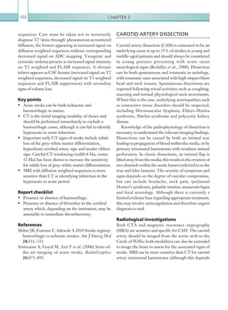 Chapter 3102
CAROTID ARTERY DISSECTION
Carotid artery dissection (CAD) is estimated to be an
underlying cause in up to 25% of strokes in young and
middle-aged patients and should always be considered
in young patients presenting with acute onset
neurological signs (Rodallec et al., 2008). Dissection
can be both spontaneous and traumatic in aetiology,
with traumatic cases associated with high-impact blunt
head and neck trauma. Spontaneous dissections are
reported following trivial activities such as coughing,
sneezing and normal physiological neck movements.
Where this is the case, underlying arteriopathies such
as connective tissue disorders should be suspected,
including fibromuscular dysplasia, Ehlers–Danlos
syndrome, Marfan syndrome and polycystic kidney
disease.
Knowledge of the pathophysiology of dissection is
necessary to understand the relevant imaging findings.
Dissections can be caused by both an intimal tear
leading to propagation of blood within the media, or by
primary intramural haematoma with resultant intimal
perforation. In classic dissections, an intimal flap is
liftedawayfromthemedia;thisresultsinthecreationof
two channels within the aortic lumen (referred to as the
true and false lumens). The severity of symptoms and
signs depends on the degree of vascular compromise,
but can include headache, neck pain, ipsilateral
Horner’s syndrome, pulsatile tinnitus, amaurosis fugax
and focal neurology. Although there is currently a
limited evidence base regarding appropriate treatment,
this may involve anticoagulation and therefore urgent
diagnosis is vital.
Radiological investigations
Both CTA and magnetic resonance angiography
(MRA) are sensitive and specific for CAD. The carotid
artery should be imaged from the aortic arch to the
Circle of Willis; both modalities can also be extended
to image the brain to assess for the associated signs of
stroke. MRI can be more sensitive than CT for carotid
artery intramural haematoma (although this depends
sequences. Care must be taken not to incorrectly
diagnose T2 ‘shine through’ phenomenon as restricted
diffusion, the former appearing as increased signal on
diffusion weighted sequences without corresponding
decreased signal on ADC mapping. Vasogenic and
cytotoxic oedema present as increased signal intensity
on T2 weighted and FLAIR sequences. A chronic
infarct appears as CSF density (increased signal on T2
weighted sequences, decreased signal on T1 weighted
sequences and FLAIR suppression) with secondary
signs of volume loss.
Key points
•	 Acute stroke can be both ischaemic and
haemorrhagic in nature.
•	 CT is the initial imaging modality of choice and
should be performed immediately to exclude a
haemorrhagic cause, although it can fail to identify
hyperacute to acute infarction.
•	 Important early CT signs of stroke include subtle
loss of the grey–white matter differentiation,
hyperdense cerebral artery sign and insular ribbon
sign. Careful CT windowing (width 8 Hu, centre
32 Hu) has been shown to increase the sensitivity
for subtle loss of grey–white matter differentiation.
•	 MRI with diffusion weighted sequences is more
sensitive than CT at identifying infarction in the
hyperacute to acute period.
Report checklist
•	 Presence or absence of haemorrhage.
•	 Presence or absence of thrombus in the cerebral
artery which, depending on the institution, may be
amenable to immediate thrombectomy.
References
Shiber JR, Fontane E, Adewale A 2010 Stroke registry:
hemorrhagic vs ischemic strokes. Am J Emerg Med
28:331–333.
Srinivasan A, Goyal M, Azri F et al. (2006) State-of-
the-art imaging of acute stroke. RadioGraphics
26:S75–S95.
K22247_C003.indd 102 16/05/15 3:08 AM
 