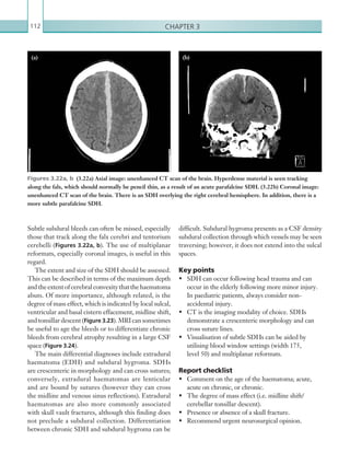 Chapter 3112
Subtle subdural bleeds can often be missed, especially
those that track along the falx cerebri and tentorium
cerebelli (Figures 3.22a, b). The use of multiplanar
reformats, especially coronal images, is useful in this
regard.
The extent and size of the SDH should be assessed.
This can be described in terms of the maximum depth
andtheextentofcerebralconvexitythatthehaematoma
abuts. Of more importance, although related, is the
degree of mass effect, which is indicated by local sulcal,
ventricular and basal cistern effacement, midline shift,
and tonsillar descent (Figure 3.23). MRI can sometimes
be useful to age the bleeds or to differentiate chronic
bleeds from cerebral atrophy resulting in a large CSF
space (Figure 3.24).
The main differential diagnoses include extradural
haematoma (EDH) and subdural hygroma. SDHs
are crescenteric in morphology and can cross sutures;
conversely, extradural haematomas are lenticular
and are bound by sutures (however they can cross
the midline and venous sinus reflections). Extradural
haematomas are also more commonly associated
with skull vault fractures, although this finding does
not preclude a subdural collection. Differentiation
between chronic SDH and subdural hygroma can be
Figures 3.22a, b  (3.22a) Axial image: unenhanced CT scan of the brain. Hyperdense material is seen tracking
along the falx, which should normally be pencil thin, as a result of an acute parafalcine SDH. (3.22b) Coronal image:
unenhanced CT scan of the brain. There is an SDH overlying the right cerebral hemisphere. In addition, there is a
more subtle parafalcine SDH.
(a) (b)
difficult. Subdural hygroma presents as a CSF density
subdural collection through which vessels may be seen
traversing; however, it does not extend into the sulcal
spaces.
Key points
•	 SDH can occur following head trauma and can
occur in the elderly following more minor injury.
In paediatric patients, always consider non-
accidental injury.
•	 CT is the imaging modality of choice. SDHs
demonstrate a crescenteric morphology and can
cross suture lines.
•	 Visualisation of subtle SDHs can be aided by
utilising blood window settings (width 175,
level 50) and multiplanar reformats.
Report checklist
•	 Comment on the age of the haematoma; acute,
acute on chronic, or chronic.
•	 The degree of mass effect (i.e. midline shift/
cerebellar tonsillar descent).
•	 Presence or absence of a skull fracture.
•	 Recommend urgent neurosurgical opinion.
K22247_C003.indd 112 16/05/15 3:08 AM
 
