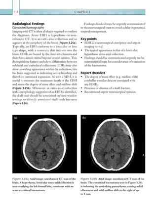 Chapter 3114
Radiological findings
Computed tomography
Imaging with CT is often all that is required to confirm
the diagnosis. Acute EDH is hyperdense on non-
enhanced CT. It is an extra-axial collection and so
appears at the periphery of the brain (Figure 3.25a).
Typically, an EDH conforms to a lenticular or lens
type shape, with a convexity that indents into the
brain. EDHs are bound by the dural attachments and
therefore cannot extend beyond cranial sutures. This
distinguishing feature can help to differentiate between
subdural and extradural collections. EDHs may also
show a swirling appearance within the collection; this
has been suggested as indicating active bleeding and
therefore continued expansion. As with a SDH, it is
useful to measure the maximum depth of the EDH
and assess the degree of mass effect and midline shift
(Figure 3.25b). Whenever an extra-axial collection
with a morphology suggestive of an EDH is identified,
the skull vault should be scrutinised on bone window
settings to identify associated skull vault fractures
(Figure 3.26).
Findings should always be urgently communicated
to the neurosurgical team to avoid a delay in potential
surgical management.
Key points
•	 EDH is a neurosurgical emergency and urgent
imaging is vital.
•	 The typical appearance is that of a lenticular,
hyperdense extra-axial collection.
•	 Findings should be communicated urgently to the
neurosurgical team for consideration of evacuation
of the haematoma.
Report checklist
•	 The degree of mass effect (e.g. midline shift/
cerebellar tonsillar descent associated with
any EDH).
•	 Presence or absence of a skull fracture.
•	 Recommend urgent neurosurgical opinion.
Figure 3.25a  Axial image: unenhanced CT scan of the
brain. A hyperdense, lenticular extra-axial collection is
seen overlying the left frontal lobe, consistent with an
acute extradural haematoma.
Figure 3.25b  Axial image: unenhanced CT scan of the
brain. The extradural haematoma seen in Figure 3.25a
is indenting the underlying parenchyma, causing sulcal
effacement and mild midline shift to the right of up
to 4 mm.
(b)(a)
K22247_C003.indd 114 16/05/15 3:08 AM
 