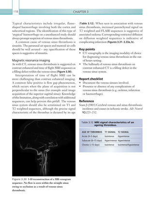 Chapter 3118
(Table 3.12). When seen in association with venous
sinus thrombosis, increased parenchymal signal on
T2 weighted and FLAIR sequences is suggestive of
associated oedema. Corresponding restricted diffusion
on diffusion weighted sequences is indicative of
complicating infarction (Figures 3.31–3.33a, b).
Key points
•	 CT venography is the imaging modality of choice
for diagnosing venous sinus thrombosis in the out
of hours setting.
•	 The hallmark of venous sinus thrombosis on
contrast enhanced CT is a filling defect in the
venous sinus system.
Report checklist
•	 Document the venous sinuses involved.
•	 Presence or absence of any complications of
venous sinus thrombosis (e.g. oedema, infarction
or haemorrhage).
Reference
Stam J (2003) Cerebral venous and sinus thrombosis:
incidence and causes in ischemic stroke. Adv Neurol
92:225–232.
Typical characteristics include irregular, flame-
shaped haemorrhage involving both the cortex and
subcortical regions. The identification of this type of
‘atypical’ haemorrhage on a unenhanced study should
always prompt suspicion of venous sinus thrombosis.
A common cause of venous sinus thrombosis is
sinusitis. The paranasal air spaces and mastoid air cells
should be well aerated – any opacification of these
spaces is suggestive of sinusitis.
Magnetic resonance imaging
As with CT, venous sinus thrombosis is suggested on
contrast enhanced and time of flight MRI sequences as
a filling defect within the venous sinus (Figure 3.30).
Interpretation of time of flight MRI can be
more challenging than contrast enhanced imaging.
A common false positive is flow gap phenomenon,
which occurs when the plane of acquisition is not
perpendicular to the sinus (for example axial image
acquisition of the superior sagittal sinus). Knowledge
ofthislimitation,alongwithcorrelationwithadditional
sequences, can help prevent this pitfall. The venous
sinus system should also be scrutinised on T1 and
T2 weighted sequences, although the precise signal
characteristic of the thrombus is dictated by its age
Figure 3.30  3-D reconstruction of a MR venogram
sequence. No flow is seen within the straight sinus
owing to occlusion as a result of venous sinus
thrombosis.
AGE OF THROMBUS T1 SIGNAL T2 SIGNAL
Acute (0–5 days) Isointense Hypointense
Subacute (6–15 days) Hyperintense Hyperintense
Chronic (15 days) Isointense Isointense/hypointense
Table 3.12 MRI signal characteristics of an
ageing thrombus.
K22247_C003.indd 118 16/05/15 3:08 AM
 