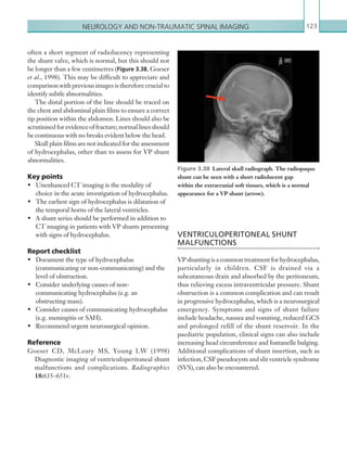 Neurology and non-traumatic spinal imaging 123
VENTRICULOPERITONEAL SHUNT
­MALFUNCTIONS
VPshuntingisacommontreatmentforhydrocephalus,
particularly in children. CSF is drained via a
subcutaneous drain and absorbed by the peritoneum,
thus relieving excess intraventricular pressure. Shunt
obstruction is a common complication and can result
in progressive hydrocephalus, which is a neurosurgical
emergency. Symptoms and signs of shunt failure
include headache, nausea and vomiting, reduced GCS
and prolonged refill of the shunt reservoir. In the
paediatric population, clinical signs can also include
increasing head circumference and fontanelle bulging.
Additional complications of shunt insertion, such as
infection, CSF pseudocysts and slit ventricle syndrome
(SVS), can also be encountered.
often a short segment of radiolucency representing
the shunt valve, which is normal, but this should not
be longer than a few centimetres (Figure 3.38, Goeser
et al., 1998). This may be difficult to appreciate and
comparison with previous images is therefore crucial to
identify subtle abnormalities.
The distal portion of the line should be traced on
the chest and abdominal plain films to ensure a correct
tip position within the abdomen. Lines should also be
scrutinisedforevidenceoffracture;normallinesshould
be continuous with no breaks evident below the head.
Skull plain films are not indicated for the assessment
of hydrocephalus, other than to assess for VP shunt
abnormalities.
Key points
•	 Unenhanced CT imaging is the modality of
choice in the acute investigation of hydrocephalus.
•	 The earliest sign of hydrocephalus is dilatation of
the temporal horns of the lateral ventricles.
•	 A shunt series should be performed in addition to
CT imaging in patients with VP shunts presenting
with signs of hydrocephalus.
Report checklist
•	 Document the type of hydrocephalus
(communicating or non-communicating) and the
level of obstruction.
•	 Consider underlying causes of non-
communicating hydrocephalus (e.g. an
obstructing mass).
•	 Consider causes of communicating hydrocephalus
(e.g. meningitis or SAH).
•	 Recommend urgent neurosurgical opinion.
Reference
Goeser CD, McLeary MS, Young LW (1998)
Diagnostic imaging of ventriculoperitoneal shunt
malfunctions and complications. Radiographics
18:635–651v.
Figure 3.38  Lateral skull radiograph. The radiopaque
shunt can be seen with a short radiolucent gap
within the extracranial soft tissues, which is a normal
appearance for a VP shunt (arrow).
K22247_C003.indd 123 16/05/15 3:08 AM
 