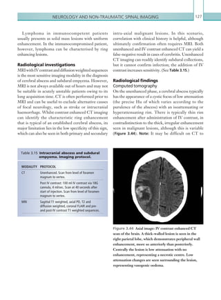 Neurology and non-traumatic spinal imaging 127
Lymphoma in immunocompetent patients
usually presents as solid mass lesions with uniform
enhancement. In the immunocompromised patient,
however, lymphoma can be characterised by ring
enhancing lesions.
Radiological investigations
MRIwithIVcontrastanddiffusionweightedsequences
is the most sensitive imaging modality in the diagnosis
of cerebral abscess and subdural empyema. However,
MRI is not always available out of hours and may not
be suitable in acutely unstable patients owing to its
long acquisition time. CT is often performed prior to
MRI and can be useful to exclude alternative causes
of focal neurology, such as stroke or intracranial
haemorrhage. Whilst contrast enhanced CT imaging
can identify the characteristic ring enhancement
that is typical of an established cerebral abscess, its
major limitation lies in the low specificity of this sign,
which can also be seen in both primary and secondary
intra-axial malignant lesions. In this scenario,
correlation with clinical history is helpful, although
ultimately confirmation often requires MRI. Both
unenhanced and IV contrast enhanced CT can yield a
false-negative result in cases of cerebritis. Unenhanced
CT imaging can readily identify subdural collections,
but it cannot confirm infection; the addition of IV
contrast increases sensitivity. (See Table 3.15.)
Radiological findings
Computed tomography
On the unenhanced phase, a cerebral abscess typically
has the appearance of a cystic focus of low attenuation
(the precise Hu of which varies according to the
purulence of the abscess) with an isoattenuating or
hyperattenuating rim. There is typically thin rim
enhancement after administration of IV contrast, in
contradistinction to the thick, irregular enhancement
seen in malignant lesions, although this is variable
(Figure 3.44). Note: It may be difficult on CT to
MODALITY PROTOCOL
CT Unenhanced. Scan from level of foramen
magnum to vertex.
Post IV contrast: 100 ml IV contrast via 18G
cannula, 4 ml/sec. Scan at 40 seconds after
start of injection. Scan from level of foramen
magnum to vertex.
MRI Sagittal T1 weighted, axial PD, T2 and
­diffusion weighted, coronal FLAIR and pre-
and post-IV contrast T1 weighted sequences.
Table 3.15 Intracranial abscess and subdural
empyema. Imaging protocol.
Figure 3.44  Axial image: IV contrast enhanced CT
scan of the brain. A thick-walled lesion is seen in the
right parietal lobe, which demonstrates peripheral wall
enhancement, more so anteriorly than posteriorly.
Centrally the lesion is low attenuation with no
enhancement, representing a necrotic centre. Low
attenuation changes are seen surrounding the lesion,
representing vasogenic oedema.
K22247_C003.indd 127 16/05/15 3:08 AM
 