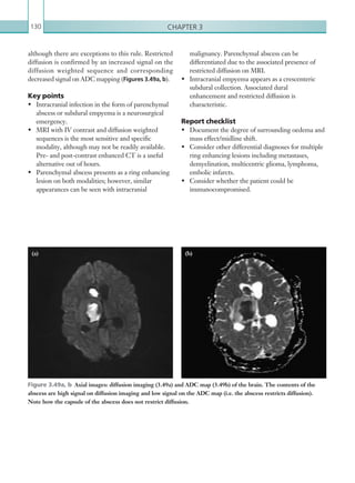 Chapter 3130
malignancy. Parenchymal abscess can be
differentiated due to the associated presence of
restricted diffusion on MRI.
•	 Intracranial empyema appears as a crescenteric
subdural collection. Associated dural
enhancement and restricted diffusion is
characteristic.
Report checklist
•	 Document the degree of surrounding oedema and
mass effect/midline shift.
•	 Consider other differential diagnoses for multiple
ring enhancing lesions including metastases,
demyelination, multicentric glioma, lymphoma,
embolic infarcts.
•	 Consider whether the patient could be
immunocompromised.
although there are exceptions to this rule. Restricted
diffusion is confirmed by an increased signal on the
diffusion weighted sequence and corresponding
decreased signal on ADC mapping (Figures 3.49a, b).
Key points
•	 Intracranial infection in the form of parenchymal
abscess or subdural empyema is a neurosurgical
emergency.
•	 MRI with IV contrast and diffusion weighted
sequences is the most sensitive and specific
modality, although may not be readily available.
Pre- and post-contrast enhanced CT is a useful
alternative out of hours.
•	 Parenchymal abscess presents as a ring enhancing
lesion on both modalities; however, similar
appearances can be seen with intracranial
Figure 3.49a, b  Axial images: diffusion imaging (3.49a) and ADC map (3.49b) of the brain. The contents of the
abscess are high signal on diffusion imaging and low signal on the ADC map (i.e. the abscess restricts diffusion).
Note how the capsule of the abscess does not restrict diffusion.
(a) (b)
K22247_C003.indd 130 16/05/15 3:08 AM
 