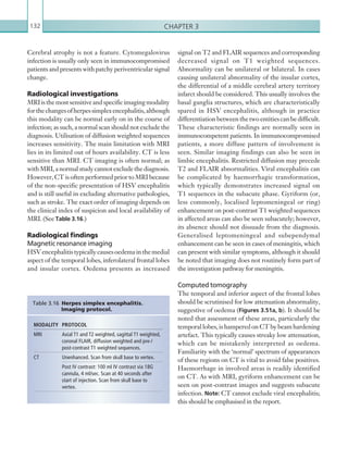 Chapter 3132
signal on T2 and FLAIR sequences and corresponding
decreased signal on T1 weighted sequences.
Abnormality can be unilateral or bilateral. In cases
causing unilateral abnormality of the insular cortex,
the differential of a middle cerebral artery territory
infarct should be considered. This usually involves the
basal ganglia structures, which are characteristically
spared in HSV encephalitis, although in practice
differentiation between the two entities can be difficult.
These characteristic findings are normally seen in
immunocompetent patients. In immunocompromised
patients, a more diffuse pattern of involvement is
seen. Similar imaging findings can also be seen in
limbic encephalitis. Restricted diffusion may precede
T2 and FLAIR abnormalities. Viral encephalitis can
be complicated by haemorrhagic transformation,
which typically demonstrates increased signal on
T1 sequences in the subacute phase. Gyriform (or,
less commonly, localised leptomeningeal or ring)
enhancement on post-contrast T1 weighted sequences
in affected areas can also be seen subacutely; however,
its absence should not dissuade from the diagnosis.
Generalised leptomeningeal and subependymal
enhancement can be seen in cases of meningitis, which
can present with similar symptoms, although it should
be noted that imaging does not routinely form part of
the investigation pathway for meningitis.
Computed tomography
The temporal and inferior aspect of the frontal lobes
should be scrutinised for low attenuation abnormality,
suggestive of oedema (Figures 3.51a, b). It should be
noted that assessment of these areas, particularly the
temporal lobes, is hampered on CT by beam hardening
artefact. This typically causes streaky low attenuation,
which can be mistakenly interpreted as oedema.
Familiarity with the ‘normal’ spectrum of appearances
of these regions on CT is vital to avoid false positives.
Haemorrhage in involved areas is readily identified
on CT. As with MRI, gyriform enhancement can be
seen on post-contrast images and suggests subacute
infection. Note: CT cannot exclude viral encephalitis;
this should be emphasised in the report.
Cerebral atrophy is not a feature. Cytomegalovirus
infection is usually only seen in immunocompromised
patients and presents with patchy periventricular signal
change.
Radiological investigations
MRIisthemostsensitiveandspecificimagingmodality
forthechangesofherpessimplexencephalitis,although
this modality can be normal early on in the course of
infection; as such, a normal scan should not exclude the
diagnosis. Utilisation of diffusion weighted sequences
increases sensitivity. The main limitation with MRI
lies in its limited out of hours availability. CT is less
sensitive than MRI. CT imaging is often normal; as
withMRI,anormalstudycannotexcludethediagnosis.
However, CT is often performed prior to MRI because
of the non-specific presentation of HSV encephalitis
and is still useful in excluding alternative pathologies,
such as stroke. The exact order of imaging depends on
the clinical index of suspicion and local availability of
MRI. (See Table 3.16.)
Radiological findings
Magnetic resonance imaging
HSVencephalitistypicallycausesoedemainthemedial
aspect of the temporal lobes, inferolateral frontal lobes
and insular cortex. Oedema presents as increased
MODALITY PROTOCOL
MRI Axial T1 and T2 weighted, sagittal T1 weighted,
coronal FLAIR, diffusion weighted and pre-/
post-contrast T1 weighted sequences.
CT Unenhanced. Scan from skull base to vertex.
Post IV contrast: 100 ml IV contrast via 18G
cannula, 4 ml/sec. Scan at 40 seconds after
start of injection. Scan from skull base to
vertex.
Table 3.16 Herpes simplex encephalitis.
Imaging protocol.
K22247_C003.indd 132 16/05/15 3:08 AM
 