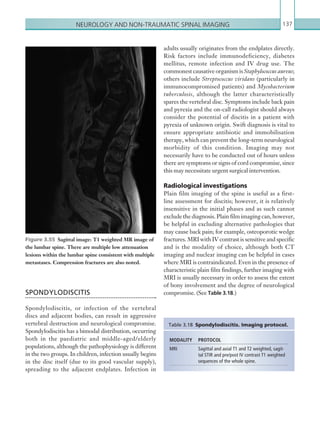 Neurology and non-traumatic spinal imaging 137
adults usually originates from the endplates directly.
Risk factors include immunodeficiency, diabetes
mellitus, remote infection and IV drug use. The
commonest causative organism is Staphylococcus aureus;
others include Streptococcus viridans (particularly in
immunocompromised patients) and Mycobacterium
tuberculosis, although the latter characteristically
spares the vertebral disc. Symptoms include back pain
and pyrexia and the on-call radiologist should always
consider the potential of discitis in a patient with
pyrexia of unknown origin. Swift diagnosis is vital to
ensure appropriate antibiotic and immobilisation
therapy, which can prevent the long-term neurological
morbidity of this condition. Imaging may not
necessarily have to be conducted out of hours unless
there are symptoms or signs of cord compromise, since
this may necessitate urgent surgical intervention.
Radiological investigations
Plain film imaging of the spine is useful as a first-
line assessment for discitis; however, it is relatively
insensitive in the initial phases and as such cannot
exclude the diagnosis. Plain film imaging can, however,
be helpful in excluding alternative pathologies that
may cause back pain; for example, osteoporotic wedge
fractures. MRI with IV contrast is sensitive and specific
and is the modality of choice, although both CT
imaging and nuclear imaging can be helpful in cases
where MRI is contraindicated. Even in the presence of
characteristic plain film findings, further imaging with
MRI is usually necessary in order to assess the extent
of bony involvement and the degree of neurological
compromise. (See Table 3.18.)SPONDYLODISCITIS
Spondylodiscitis, or infection of the vertebral
discs and adjacent bodies, can result in aggressive
vertebral destruction and neurological compromise.
Spondylodiscitis has a bimodal distribution, occurring
both in the paediatric and middle-aged/elderly
populations, although the pathophysiology is different
in the two groups. In children, infection usually begins
in the disc itself (due to its good vascular supply),
spreading to the adjacent endplates. Infection in
Figure 3.55  Sagittal image: T1 weighted MR image of
the lumbar spine. There are multiple low attenuation
lesions within the lumbar spine consistent with multiple
metastases. Compression fractures are also noted.
MODALITY PROTOCOL
MRI Sagittal and axial T1 and T2 weighted, sagit-
tal STIR and pre/post IV contrast T1 weighted
sequences of the whole spine.
Table 3.18  Spondylodiscitis. Imaging protocol.
K22247_C003.indd 137 16/05/15 3:08 AM
 