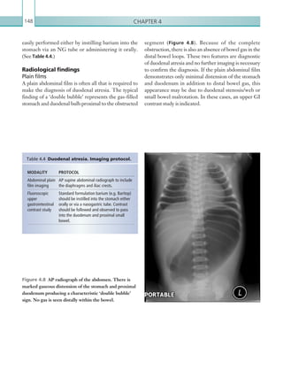 Chapter 4148
segment (Figure 4.8). Because of the complete
obstruction, there is also an absence of bowel gas in the
distal bowel loops. These two features are diagnostic
of duodenal atresia and no further imaging is necessary
to confirm the diagnosis. If the plain abdominal film
demonstrates only minimal distension of the stomach
and duodenum in addition to distal bowel gas, this
appearance may be due to duodenal stenosis/web or
small bowel malrotation. In these cases, an upper GI
contrast study is indicated.
easily performed either by instilling barium into the
stomach via an NG tube or administering it orally.
(See Table 4.4.)
Radiological findings
Plain films
A plain abdominal film is often all that is required to
make the diagnosis of duodenal atresia. The typical
finding of a ‘double bubble’ represents the gas-filled
stomach and duodenal bulb proximal to the obstructed
Figure 4.8  AP radiograph of the abdomen. There is
marked gaseous distension of the stomach and proximal
duodenum producing a characteristic ‘double bubble’
sign. No gas is seen distally within the bowel.
MODALITY PROTOCOL
Abdominal plain
film imaging
AP supine abdominal radiograph to include
the diaphragms and iliac crests.
­Fluoroscopic
upper
­gastrointestinal
contrast study
Standard formulation barium (e.g. Baritop)
should be instilled into the stomach either
orally or via a nasogastric tube. Contrast
should be followed and observed to pass
into the duodenum and proximal small
bowel.
Table 4.4  Duodenal atresia. Imaging protocol.
K22247_C004.indd 148 16/05/15 3:10 AM
 