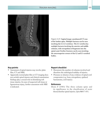 Trauma imaging 189
Report checklist
•	 Document the number of columns involved and
therefore the radiological stability of injuries.
•	 Presence or absence of any evidence of spinal cord
compromise (e.g. bony retropulsion, epidural
haematoma, cord injury).
Reference
Denis F (1983) The three column spine and
its significance in the classification of acute
thoracolumbar spinal injuries. Spine 8:817–831.
Key points
•	 Assessment of spinal injuries may involve plain
film, CT and MRI.
•	 Apparently normal plain film or CT imaging does
not exclude spinal injuries and clinical examination
findings play a crucial role in identifying soft
tissue injuries. In cases of suspected soft tissue or
ligamentous injury, further assessment with MRI
is indicated.
Figure 5.41  Sagittal image: unenhanced CT scan
of the lumbar spine. Multiple fractures can be seen
involving the L1–L3 vertebrae. The L1 vertebra has
multiple fractures involving the anterior and middle
columns, with retropulsion of fragments into the
spinal canal. Further fractures can be seen involving
the anterosuperior corners of the L2 and L3 vertebral
bodies.
K22247_C005.indd 189 16/05/15 3:11 AM
 