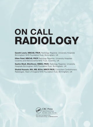 ON CALL
RADIOLOGY
Gareth Lewis, MBChB, FRCR, Radiology Registrar, University Hospitals
Birmingham NHS Foundation Trust, Birmingham, UK
Hiten Patel, MBChB, FRCR Radiology Registrar, University Hospitals
Coventry and Warwickshire NHS Trust, Coventry, UK
Sachin Modi, BSc(Hons), MBBS, FRCR, Radiology Registrar, University
Hospitals Birmingham NHS Foundation Trust, Birmingham, UK
Shahid Hussain, MA, MB, BChir, MRCP, FRCR, Consultant Cardiothoracic
Radiologist, Heart of England NHS Foundation Trust, Birmingham, UK
ON CALL
RADIOLOGY
Gareth Lewis, MBChB, FRCR, Radiology Registrar, University Hospitals
Birmingham NHS Foundation Trust, Birmingham, UK
Hiten Patel, MBChB, FRCR Radiology Registrar, University Hospitals
Coventry and Warwickshire NHS Trust, Coventry, UK
Sachin Modi, BSc(Hons), MBBS, FRCR, Radiology Registrar, University
Hospitals Birmingham NHS Foundation Trust, Birmingham, UK
Shahid Hussain, MA, MB, BChir, MRCP, FRCR, Consultant Cardiothoracic
Radiologist, Heart of England NHS Foundation Trust, Birmingham, UK
K22247_FM.indd 1 16/05/15 3:05 AM
 