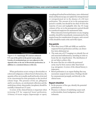Gastrointestinal and genitourinary imaging 35
oesophageal/trachealbronchialinjury,intra-abdominal
drainsandhysteroscopycanexplainfreeintraperitoneal
or retroperitoneal air in the absence of a GI tract
perforation. The amount of air in the postoperative
period is variable, but should be less than 10 ml in the
majority of cases and negligible after day 10. Large
volumes of free air in the postoperative period should
be considered suspicious for anastomotic leaks.
When detected, bowel perforation on any imaging
modality should be immediately communicated to the
surgical team for consideration of surgery, and a record
of this should be made at the end of the report.
Key points
•	 Plain films (erect CXR and AXR) are useful for
suspected bowel perforation and they can detect
free intra-abdominal air.
•	 The main aim of CT imaging is to identify free air
and associated inflammatory stranding in order to
locate the site of perforation. The distribution of
air can help to achieve this.
•	 Be aware that free air within the peritoneal
cavity may be from sources other than bowel
(e.g. iatrogenic). A review of the clinical history is
imperative.
•	 Bowel perforation is an urgent finding that may
necessitate surgical intervention. Findings should
be communicated promptly and directly to the
clinical team.
Report checklist
•	 In the presence of free gas, identify the potential
perforated site.
•	 Presence or absence of underlying causes such
as diverticulitis, bowel malignancy and bowel
ischaemia.
When perforation occurs owing to diverticulitis or
colorectal malignancy without bowel obstruction, the
quantityoffreeairisusuallysmallandloculesofairtend
to be concentrated in close proximity to the involved
colonic loops. The presence of free air, phlegmon
and/or an abscess, an extraluminal collection and the
underlying colonic abnormality (neoplasm) should be
carefully evaluated on CT scans.
A review of the clinical history is important when
reviewing CT for suspected bowel perforation.
A history of recent surgery (laparoscopic or open),
Figure 2.15  Axial image: IV contrast enhanced
CT scan of the pelvis in the portal venous phase.
Locules of extraluminal gas are seen adjacent to the
sigmoid colon at the site of diverticular perforation, in
addition to a contained abscess at this site.
K22247_C002.indd 35 16/05/15 3:07 AM
 