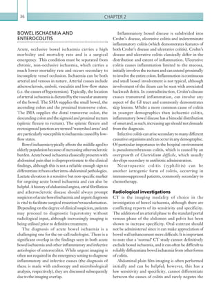 Chapter 236
Inflammatory bowel disease is subdivided into
Crohn’s disease, ulcerative colitis and indeterminate
inflammatory colitis (which demonstrates features of
both Crohn’s disease and ulcerative colitis). Crohn’s
disease and ulcerative colitis classically differ in the
distribution and extent of inflammation. Ulcerative
colitis causes inflammation limited to the mucosa,
initially involves the rectum and can extend proximally
to involve the entire colon. Inflammation is continuous
and small bowel involvement is not typical, although
involvement of the ileum can be seen with associated
backwash ileitis. In contradistinction, Crohn’s disease
causes transmural inflammation, can involve any
aspect of the GI tract and commonly demonstrates
skip lesions. Whilst a more common cause of colitis
in younger demographics than ischaemic colitis,
inflammatory bowel disease has a bimodal distribution
ofonsetand,assuch,increasingageshouldnotdissuade
from the diagnosis.
Infectivecolitiscanarisesecondarytomanydifferent
causative organisms and can occur in any demographic.
Of particular importance in the hospital environment
is pseudomembranous colitis, which is caused by an
overgrowth of Clostridium difficile, which usually
develops secondary to antibiotic administration.
Neutropaenic colitis (typhilitis) can be
another iatrogenic form of colitis, occurring in
immunosuppressed patients, commonly secondary to
chemotherapy.
Radiological investigations
CT is the imaging modality of choice in the
investigation of bowel ischaemia, although there are
conflicting reports of its sensitivity and specificity.
The addition of an arterial phase to the standard portal
venous phase of the abdomen and pelvis has been
shown to increase specificity. Oral contrast should
not be administered since it can make appreciation of
bowel wall enhancement more difficult. It is important
to note that a ‘normal’ CT study cannot definitively
exclude bowel ischaemia, and it can often be difficult to
reliably differentiate bowel ischaemia from other forms
of colitis.
Abdominal plain film imaging is often performed
initially and can be helpful; however, this has a
low sensitivity and specificity, cannot differentiate
between the causes of colitis and rarely negates the
BOWEL ISCHAEMIA AND
ENTEROCOLITIS
Acute, occlusive bowel ischaemia carries a high
morbidity and mortality rate and is a surgical
emergency. This condition must be separated from
chronic, non-occlusive ischaemia, which carries a
much lower mortality rate and occurs secondary to
incomplete vessel occlusion. Ischaemia can be both
arterial and venous in nature. Arterial causes include
atherosclerosis, emboli, vasculitis and low-flow states
(i.e. the causes of hypotension). Typically, the location
of arterial ischaemia is dictated by the vascular anatomy
of the bowel. The SMA supplies the small bowel, the
ascending colon and the proximal transverse colon.
The IMA supplies the distal transverse colon, the
descendingcolonandthesigmoidandproximalrectum
(splenic flexure to rectum). The splenic flexure and
rectosigmoid junction are termed ‘watershed areas’ and
are particularly susceptible to ischaemia caused by low-
flow states.
Bowel ischaemia typically affects the middle aged to
elderlypopulationbecauseofincreasingatherosclerotic
burden.Acutebowelischaemiaclassicallypresentswith
abdominal pain that is disproportionate to the clinical
findings, although this is not a reliable enough sign to
differentiateitfromotherintra-abdominalpathologies.
Lactate elevation is a sensitive but non-specific marker
for ongoing acute bowel ischaemia and can also be
helpful.Ahistoryofabdominalangina,atrialfibrillation
and atherosclerotic disease should always prompt
suspicionofacutebowelischaemiaandurgentdiagnosis
is vital to facilitate surgical resection/revascularisation.
Depending on the degree of clinical suspicion, patients
may proceed to diagnostic laparotomy without
radiological input, although increasingly imaging is
being utilised prior to definitive treatment.
The diagnosis of acute bowel ischaemia is a
challenging one for the on-call radiologist. There is a
significant overlap in the findings seen in both acute
bowel ischaemia and other inflammatory and infective
aetiologies of enterocolitis. While urgent imaging is
oftennotrequiredintheemergencysettingtodiagnose
inflammatory and infective causes (the diagnosis of
these is made with endoscopy and microbiological
analysis, respectively), they are discussed subsequently
due to the imaging overlap.
K22247_C002.indd 36 16/05/15 3:07 AM
 