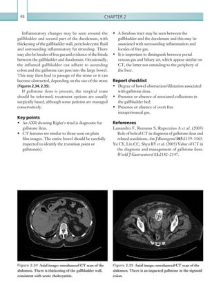 Chapter 248
•	 A fistulous tract may be seen between the
gallbladder and the duodenum and this may be
associated with surrounding inflammation and
locules of free gas.
•	 It is important to distinguish between portal
venous gas and biliary air, which appear similar on
CT, the latter not extending to the periphery of
the liver.
Report checklist
•	 Degree of bowel obstruction/dilatation associated
with gallstone ileus.
•	 Presence or absence of associated collections in
the gallbladder bed.
•	 Presence or absence of overt free
intraperitoneal gas.
References
Lassandro F, Romano S, Ragozzino A et al. (2005)
Role of helical CT in diagnosis of gallstone ileus and
relatedconditions. Am J Roentgenol 185:1159–1165.
Yu CY, Lin CC, Shyu RY et al. (2005) Value of CT in
the diagnosis and management of gallstone ileus.
World J Gastroenterol 11:2142–2147.
Inflammatory changes may be seen around the
gallbladder and second part of the duodenum, with
thickening of the gallbladder wall, pericholecystic fluid
and surrounding inflammatory fat stranding. There
mayalsobeloculesoffreegasandevidenceofthefistula
between the gallbladder and duodenum. Occasionally,
the inflamed gallbladder can adhere to ascending
colon and the gallstone can pass into the large bowel.
This may then lead to passage of the stone or it can
become obstructed, depending on the size of the stone
(Figures 2.34, 2.35).
If gallstone ileus is present, the surgical team
should be informed; treatment options are usually
surgically based, although some patients are managed
conservatively.
Key points
•	 An AXR showing Rigler’s triad is diagnostic for
gallstone ileus.
•	 CT features are similar to those seen on plain
film images. The entire bowel should be carefully
inspected to identify the transition point or
gallstone(s).
Figure 2.34  Axial image: unenhanced CT scan of the
abdomen. There is thickening of the gallbladder wall,
consistent with acute cholecystitis.
Figure 2.35  Axial image: unenhanced CT scan of the
abdomen. There is an impacted gallstone in the sigmoid
colon.
K22247_C002.indd 48 16/05/15 3:07 AM
 