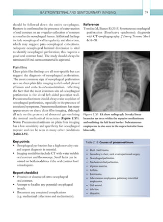 Gastrointestinal and genitourinary imaging 59
•	 Blunt chest trauma.
•	 Secondary to chest, neck or retroperitoneal surgery.
•	 Oesophageal perforation.
•	 Tracheobronchial perforation.
•	 Vigorous exercise.
•	 Asthma.
•	 Barotrauma.
•	 Subcutaneous emphysema, pulmonary interstitial
emphysema.
•	 Stab wound.
•	 Infection.
•	 Idiopathic.
Table 2.15  Causes of pneumostinum.
Figure 2.51  PA chest radiograph. Streaky linear
­lucencies are seen within the superior mediastinum
and outlining the left heart border. Subcutaneous
­emphysema is also seen in the supraclavicular fossa
bilaterally.
Reference
Tonolini M, Bianco R (2013) Spontaneous esophageal
perforation (Boerhaave syndrome): diagnosis
with CT-esophagography. J Emerg Trauma Shock
6:58–60.
should be followed down the entire oesophagus.
Rupture is confirmed in the presence of extravasation
of oral contrast or an irregular collection of contrast
external to the oesophageal lumen. Additional findings
include oesophageal wall irregularity and distortion,
which may suggest para-oesophageal collections.
Adequate oesophageal luminal distension is vital
to identify oesophageal perforation; this requires a
good oral contrast load. The study should always be
terminated if oral contrast material is aspirated.
Plain films
Chest plain film findings are all non-specific but can
suggest the diagnosis of oesophageal perforation.
The most common sign of oesophageal perforation
seen on chest plain film imaging is a left-sided pleural
effusion and atelectasis/consolidation, reflecting
the fact that the most common site of oesophageal
perforation is the distal left-sided posterior wall.
Pneumomediastinum should always raise suspicion of
oesophageal perforation, especially in the presence of
associated symptoms. Pneumomediastinum has many
appearances on chest plain film imaging, although
all rely on the presence of abnormal gas outlining
the normal mediastinal structures (Figure 2.51).
Note: Pneumomediastinum on plain film imaging
has a low sensitivity and specificity for oesophageal
rupture and can be seen in many other conditions
(Table 2.15).
Key points
•	 Oesophageal perforation has a high mortality rate
and urgent diagnosis is essential.
•	 Imaging modalities include CT with water soluble
oral contrast and fluoroscopy. Small leaks can be
missed on both modalities if the oral contrast load
is inadequate.
Report checklist
•	 Presence or absence of extra-oesophageal
oral contrast.
•	 Attempt to localise any potential oesophageal
breach.
•	 Document any associated complications
(e.g. mediastinal collections and mediastinitis).
K22247_C002.indd 59 16/05/15 3:07 AM
 