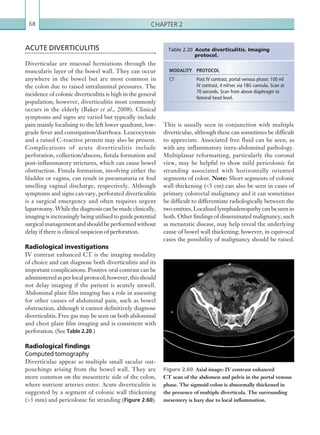 Chapter 268
ACUTE DIVERTICULITIS
Diverticulae are mucosal herniations through the
muscularis layer of the bowel wall. They can occur
anywhere in the bowel but are most common in
the colon due to raised intraluminal pressures. The
incidence of colonic diverticulitis is high in the general
population; however, diverticulitis most commonly
occurs in the elderly (Baker et al., 2008). Clinical
symptoms and signs are varied but typically include
pain mainly localising to the left lower quadrant, low-
grade fever and constipation/diarrhoea. Leucocytosis
and a raised C-reactive protein may also be present.
Complications of acute diverticulitis include
perforation, collection/abscess, fistula formation and
post-inflammatory strictures, which can cause bowel
obstruction. Fistula formation, involving either the
bladder or vagina, can result in pneumaturia or foul
smelling vaginal discharge, respectively. Although
symptoms and signs can vary, perforated diverticulitis
is a surgical emergency and often requires urgent
laparotomy.Whilethediagnosiscanbemadeclinically,
imaging is increasingly being utilised to guide potential
surgicalmanagementandshouldbeperformedwithout
delay if there is clinical suspicion of perforation.
Radiological investigations
IV contrast enhanced CT is the imaging modality
of choice and can diagnose both diverticulitis and its
important complications. Positive oral contrast can be
administeredasperlocalprotocol;however,thisshould
not delay imaging if the patient is acutely unwell.
Abdominal plain film imaging has a role in assessing
for other causes of abdominal pain, such as bowel
obstruction, although it cannot definitively diagnose
diverticulitis. Free gas may be seen on both abdominal
and chest plain film imaging and is consistent with
perforation. (See Table 2.20.)
Radiological findings
Computed tomography
Diverticulae appear as multiple small sacular out-
pouchings arising from the bowel wall. They are
more common on the mesenteric side of the colon,
where nutrient arteries enter. Acute diverticulitis is
suggested by a segment of colonic wall thickening
(3 mm) and pericolonic fat stranding (Figure 2.60).
MODALITY PROTOCOL
CT Post IV contrast, portal venous phase: 100 ml
IV contrast, 4 ml/sec via 18G cannula. Scan at
70 seconds. Scan from above diaphragm to
femoral head level.
Table 2.20 Acute diverticulitis. Imaging
protocol.
Figure 2.60  Axial image: IV contrast enhanced
CT scan of the abdomen and pelvis in the portal venous
phase. The sigmoid colon is abnormally thickened in
the ­presence of multiple diverticula. The surrounding
­mesentery is hazy due to local inflammation.
This is usually seen in conjunction with multiple
diverticulae, although these can sometimes be difficult
to appreciate. Associated free fluid can be seen, as
with any inflammatory intra-abdominal pathology.
Multiplanar reformatting, particularly the coronal
view, may be helpful to show mild pericolonic fat
stranding associated with horizontally oriented
segments of colon. Note: Short segments of colonic
wall thickening (5 cm) can also be seen in cases of
primary colorectal malignancy and it can sometimes
be difficult to differentiate radiologically between the
twoentities.Localisedlymphadenopathycanbeseenin
both. Other findings of disseminated malignancy, such
as metastatic disease, may help reveal the underlying
cause of bowel wall thickening; however, in equivocal
cases the possibility of malignancy should be raised.
K22247_C002.indd 68 16/05/15 3:07 AM
 