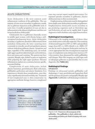Gastrointestinal and genitourinary imaging 71
cases may warrant urgent surgical intervention. For
repeated episodes secondary to gallstones, elective
cholecystectomy is often recommended.
Emphysematous cholecystitis must be distinguished
from simple acute cholecystitis secondary to gallstones.
Emphysematous cholecystitis occurs secondary to
gas producing organisms such as Clostridium spp.
and Escherichia coli and can be rapidly fatal. Urgent
diagnosis is vital to facilitate early surgical intervention.
Radiological investigations
Ultrasound is the imaging modality of choice when
acutecholecystitisisclinicallysuspected.Thesensitivity
of ultrasound ranges from 80% to 100% and specificity
ranges from 60% to 100% (Smith et al., 2009). CT
can also be used to diagnose cholecystitis and may be
a more appropriate first-line investigation in suspected
cases of complicated acute cholecystitis; however, CT
is less sensitive than ultrasound for subtle gallbladder
wall changes. Plain film imaging can yield signs such
as radiopaque gallstones or pneumobilia, but it is not
diagnostic. (See Table 2.22.)
Radiological findings
Ultrasound
Findings on ultrasound include gallbladder wall
thickening (3 mm), pericholecystic hypoechoic fluid
andthepresenceofapositivesonographicMurphysign
(Figure 2.65).Gallbladderwallthickeninginisolationis
ACUTE CHOLECYSTITIS
Acute cholecystitis is the most common acute
inflammatory condition of the gallbladder. The vast
majority of cases occur secondary to gallstones, usually
due to gallstone impaction in the gallbladder neck or
cystic duct. A smaller proportion of cases are due to
inflammation in the absence of gallstones and these are
termed acalculous cholecystitis.
Cholecystitis due to gallstones classically occurs
in middle-aged women, with obesity being a well-
recognised predisposing factor. Acute cholecystitis
secondary to gallstones should be differentiated from
acalculous cholecystitis, the latter occurring more
commonly in critically unwell and paediatric patients
without underlying gallstone disease. Symptoms and
signs, regardless of the underlying cause, can include
right upper quadrant abdominal pain and tenderness,
fever and nausea and vomiting. The patient may have
a positive Murphy sign, defined as pain on inspiration
while palpating the right upper quadrant. Elevated
inflammatory markers are a common, but non-specific,
associated finding.
Complications of acute cholecystitis include
abscess formation, pericholecystic fluid collections,
gallbladder perforation and enteric fistulation. It is
important to identify these complications, since they
carryasignificantlyincreasedmortalityrate.Treatment
of non-complicated cases is often conservative via
appropriate antibiotic therapy; however, complicated
MODALITY PROTOCOL
Ultrasound 1–5MHz curvilinear probe.
CT Post IV contrast, portal venous phase: 100
ml IV contrast, 4 ml/sec via 18G cannula.
Scan at 70 seconds. Scan from just above
diaphragm to femoral head level.
Table 2.22 Acute cholecystitis. Imaging
protocol.
Figure 2.65  Transverse ultrasonogram of the
­gallbladder. The gallbladder is thick walled with
­surrounding pericholecystic fluid in keeping with acute
cholecystitis.
K22247_C002.indd 71 16/05/15 3:07 AM
 