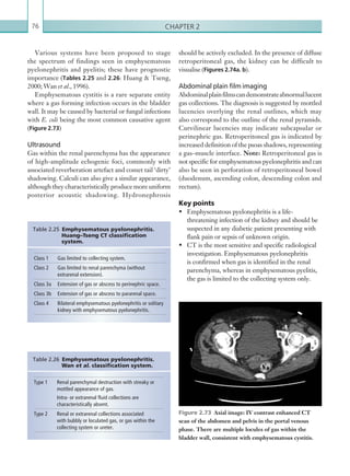 Chapter 276
should be actively excluded. In the presence of diffuse
retroperitoneal gas, the kidney can be difficult to
visualise (Figures 2.74a. b).
Abdominal plain film imaging
Abdominalplainfilmscandemonstrateabnormallucent
gas collections. The diagnosis is suggested by mottled
lucencies overlying the renal outlines, which may
also correspond to the outline of the renal pyramids.
Curvilinear lucencies may indicate subcapsular or
perinephric gas. Retroperitoneal gas is indicated by
increased definition of the psoas shadows, representing
a gas–muscle interface. Note: Retroperitoneal gas is
not specific for emphysematous pyelonephritis and can
also be seen in perforation of retroperitoneal bowel
(duodenum, ascending colon, descending colon and
rectum).
Key points
•	 Emphysematous pyelonephritis is a life-
threatening infection of the kidney and should be
suspected in any diabetic patient presenting with
flank pain or sepsis of unknown origin.
•	 CT is the most sensitive and specific radiological
investigation. Emphysematous pyelonephritis
is confirmed when gas is identified in the renal
parenchyma, whereas in emphysematous pyelitis,
the gas is limited to the collecting system only.
Various systems have been proposed to stage
the spectrum of findings seen in emphysematous
pyelonephritis and pyelitis; these have prognostic
importance (Tables 2.25 and 2.26: Huang  Tseng,
2000; Wan et al., 1996).
Emphysematous cystitis is a rare separate entity
where a gas forming infection occurs in the bladder
wall. It may be caused by bacterial or fungal infections
with E. coli being the most common causative agent
(Figure 2.73)
Ultrasound
Gas within the renal parenchyma has the appearance
of high-amplitude echogenic foci, commonly with
associated reverberation artefact and comet tail ‘dirty’
shadowing. Calculi can also give a similar appearance,
although they characteristically produce more uniform
posterior acoustic shadowing. Hydronephrosis
Class 1 Gas limited to collecting system.
Class 2 Gas limited to renal parenchyma (without
­extrarenal extension).
Class 3a Extension of gas or abscess to perinephric space.
Class 3b Extension of gas or abscess to pararenal space.
Class 4 Bilateral emphysematous pyelonephritis or solitary
kidney with emphysematous pyelonephritis.
Table 2.25 Emphysematous pyelonephritis.
Huang–Tseng CT classification
system.
Type 1 Renal parenchymal destruction with streaky or
mottled appearance of gas.
Intra- or extrarenal fluid collections are
­characteristically absent.
Type 2 Renal or extrarenal collections associated
with bubbly or loculated gas, or gas within the
­collecting system or ureter.
Table 2.26 Emphysematous pyelonephritis.
Wan et al. classification system.
Figure 2.73  Axial image: IV contrast enhanced CT
scan of the abdomen and pelvis in the portal venous
phase. There are multiple locules of gas within the
bladder wall, consistent with ­emphysematous cystitis.
K22247_C002.indd 76 16/05/15 3:07 AM
 