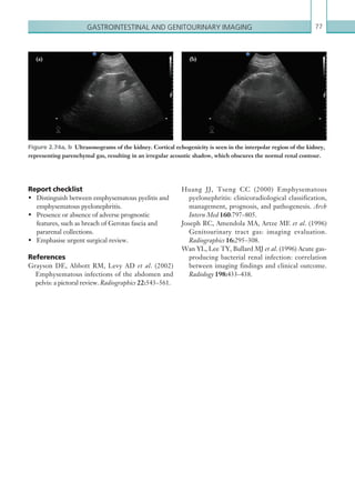Gastrointestinal and genitourinary imaging 77
Huang JJ, Tseng CC (2000) Emphysematous
pyelonephritis: clinicoradiological classification,
management, prognosis, and pathogenesis. Arch
Intern Med 160:797–805.
Joseph RC, Amendola MA, Artze ME et al. (1996)
Genitourinary tract gas: imaging evaluation.
Radiographics 16:295–308.
Wan YL, Lee TY, Bullard MJ et al. (1996) Acute gas-
producing bacterial renal infection: correlation
between imaging findings and clinical outcome.
Radiology 198:433–438.
Report checklist
•	 Distinguish between emphysematous pyelitis and
emphysematous pyelonephritis.
•	 Presence or absence of adverse prognostic
features, such as breach of Gerotas fascia and
pararenal collections.
•	 Emphasise urgent surgical review.
References
Grayson DE, Abbott RM, Levy AD et al. (2002)
Emphysematous infections of the abdomen and
pelvis: a pictoral review. Radiographics 22:543–561.
Figure 2.74a, b  Ultrasonograms of the kidney. Cortical echogenicity is seen in the interpolar region of the kidney,
representing parenchymal gas, resulting in an irregular acoustic shadow, which obscures the normal renal contour.
(a) (b)
K22247_C002.indd 77 16/05/15 3:07 AM
 