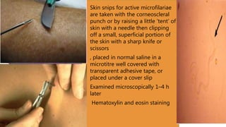 Onchiocerciasis in ethiopia | PPTX