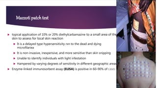 Onchiocerciasis in ethiopia | PPTX