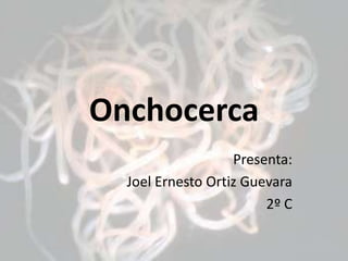 Onchocerca Presenta:  Joel Ernesto Ortiz Guevara 2º C 