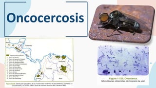 Oncocercosis
 