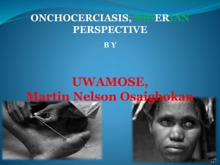 ONCHOCERCIASIS, NIGERIAN 
PERSPECTIVE 
B Y 
UWAMOSE, 
Martin Nelson Osaigbokan 
 