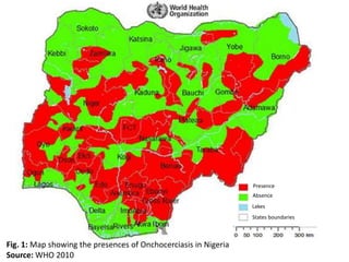 Presence 
Absence 
Lakes 
States boundaries 
Fig. 1: Map showing the presences of Onchocerciasis in Nigeria 
Source:WHO 2010 
 