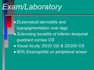 Exam/Laboratory
●Eczematoid dermatitis and
hypopigmentation over legs
●Sclerosing keratitis of inferior temporal
quadrant cornea OS
●Visual Acuity 20/20 OD & 20/200 OS
●90% Eosinophilia on peripheral smear
 