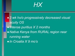HX
●3 wk hx/o progressively decreased visual
acuity OS
●Intense puritius X 2 months
●Native Kenya from RURAL region near
running water
●In Croatia X 9 mo’s
 