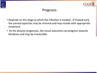Prognosis
• Depends on the stage at which the infection is treated , if treated early
the corneal opacities may be minimal and may recede with appropriate
treatment.
• As the disease progresses, the visual outcomes can progress towards
blindness and may be irreversible.
 