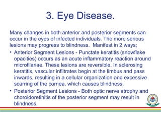 3. Eye Disease.
Many changes in both anterior and posterior segments can
occur in the eyes of infected individuals. The more serious
lesions may progress to blindness. Manifest in 2 ways;
• Anterior Segment Lesions - Punctate keratitis (snowflake
opacities) occurs as an acute inflammatory reaction around
microfilariae. These lesions are reversible. In sclerosing
keratitis, vascular infiltrates begin at the limbus and pass
inwards, resulting in a cellular organization and excessive
scarring of the cornea, which causes blindness.
• Posterior Segment Lesions - Both optic nerve atrophy and
choroidoretinitis of the posterior segment may result in
blindness.
 