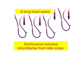 Onchocerca volvulus
microfilariae from skin snips
A long head space
 