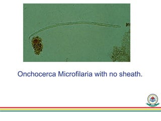 Onchocerca Microfilaria with no sheath.
 