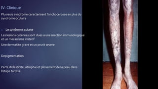 IV. Clinique
Plusieurs syndrome caracterisent l’onchocercose en plus du
syndrome oculaire
a. Le syndrome cutane
Les lesions cutanees sont dues a une reaction immunologique
et un mecanisme irritatif
Une dermatite grave et un prurit severe
Depigmentation
Perte d’elasticite, atrophie et plissement de la peau dans
l’etape tardive
 