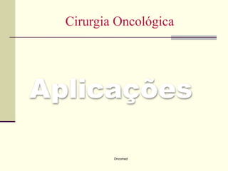 Cirurgia Oncológica




Aplicações

          Oncomed
 