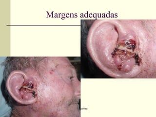 Margens adequadas




       Oncomed
 