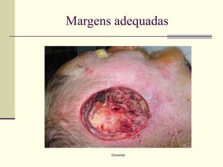 Margens adequadas




       Oncomed
 