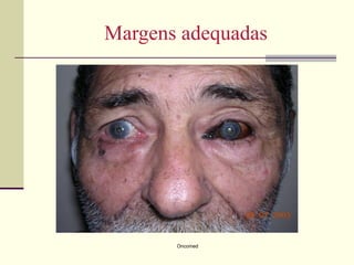 Margens adequadas




       Oncomed
 